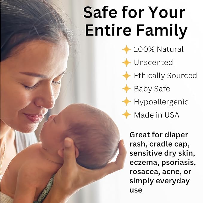 Whipped Beef Tallow for Skin – 100% Grass Fed Tallow Moisturizer for Face, Organic Body Butter, Rosacea, Eczema, Babies, Sensitive Skin (Unscented) 2oz