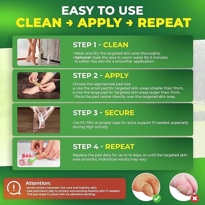 Corn Remover Pads for Feet Toes: 2 Boxes of 30 Pack Salicylic Acid Extra Strength Treatment - Fast Effective Medicated Bandages for Kids Adults Seniors Teens Runners Hikers Workers Men Women 02