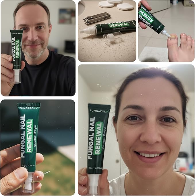 Toenail Fungus Pen - Tea Tree Oil for Toenail Fungus - Antifungal Nail Treatment with Tea Tree Oil - Fast-Acting, No-Touch Applicator - Restores Thickness & Discoloration - 20ML Volume