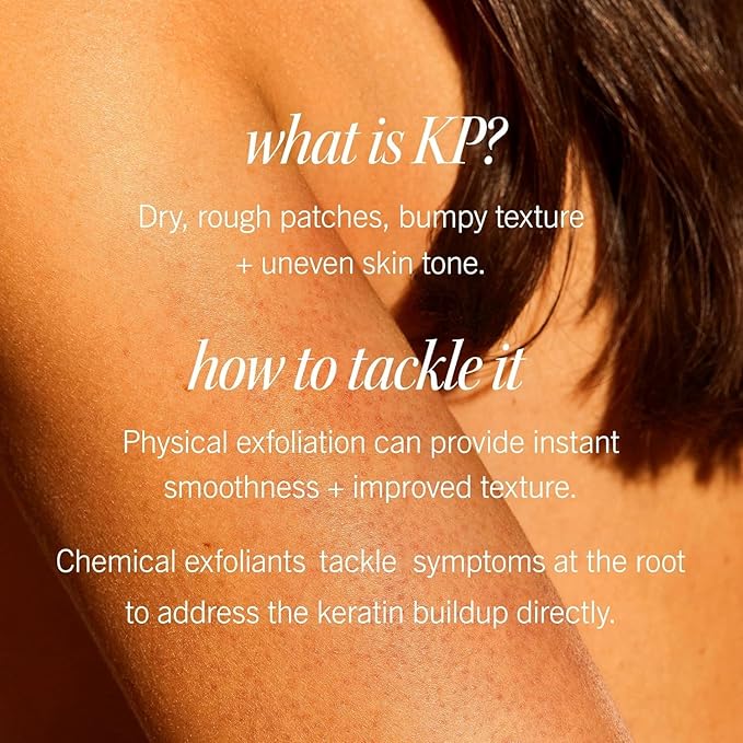 First Aid Beauty - KP Bump Eraser Body Scrub with 10% AHA, Keratosis Pilaris Skin Exfoliator with Glycolic and Lactic acids, Helps Reduce Chicken Bumps, Safe for Sensitive Skin, 2 oz