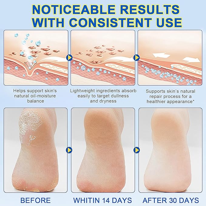 60% Urea Cream Stick with 2% Salicylic Acid, Maximum Strength Urea Foot Cream Moisturizer, for Dry Cracked Heels, Knees, Elbows, Hands, Hydrates Dry Skin & Gently Exfoliates Dead Skin (2PCS)