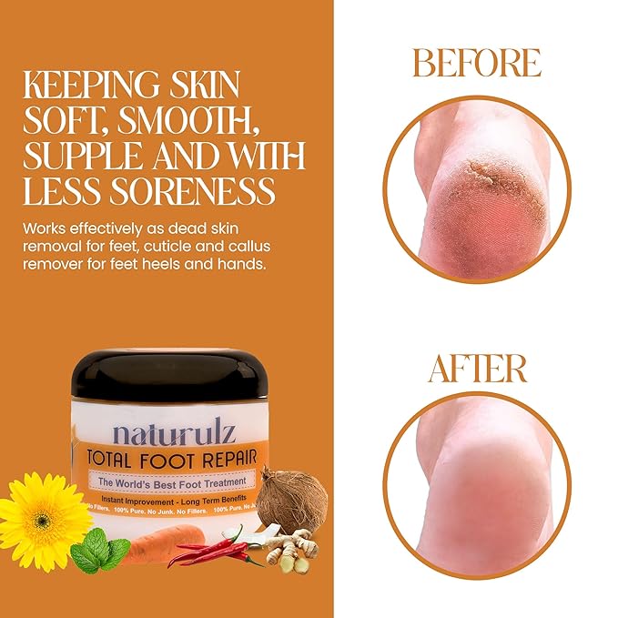 Naturulz Total Foot Repair 4oz – Intensive Moisture Foot Cream for Extremely Dry, Rough Skin & Cracked Heels and Feet- Moisture Barrier Repair for Knees, Elbows & Hands Formulated for Sensative Skin