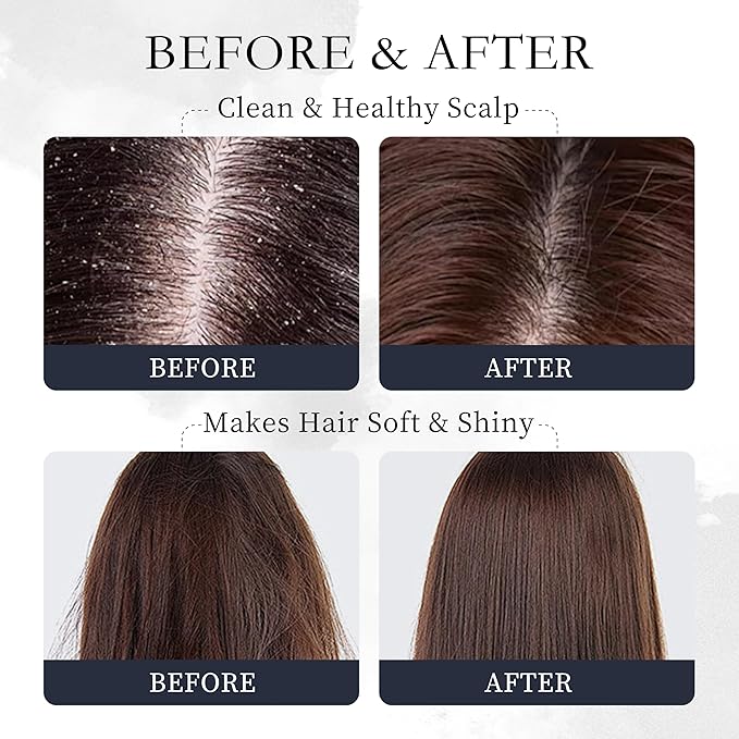 Rosemary Hair Oil – Dry Scalp & Split End Treatment with Biotin & Essential Oils for Strengthening, Nourishing, Moisturizing & Supporting Longer, Healthier Hair