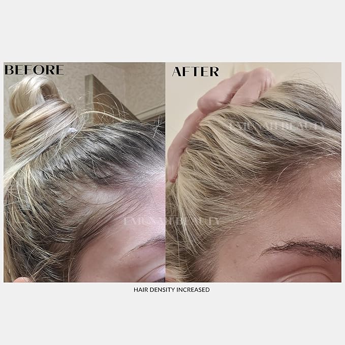 Hair Growth Oil Scalp Treatment