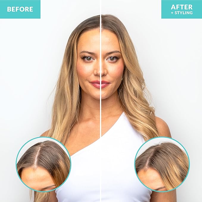 FoxyBae Dry Shampoo Powder – Non-Aerosol Formula with Biotin, Tapioca & Arrowroot – Absorbs Oil & Adds Volume – For Dark, Brunette & Blonde Hair – Beach Whisper – 1.3 oz