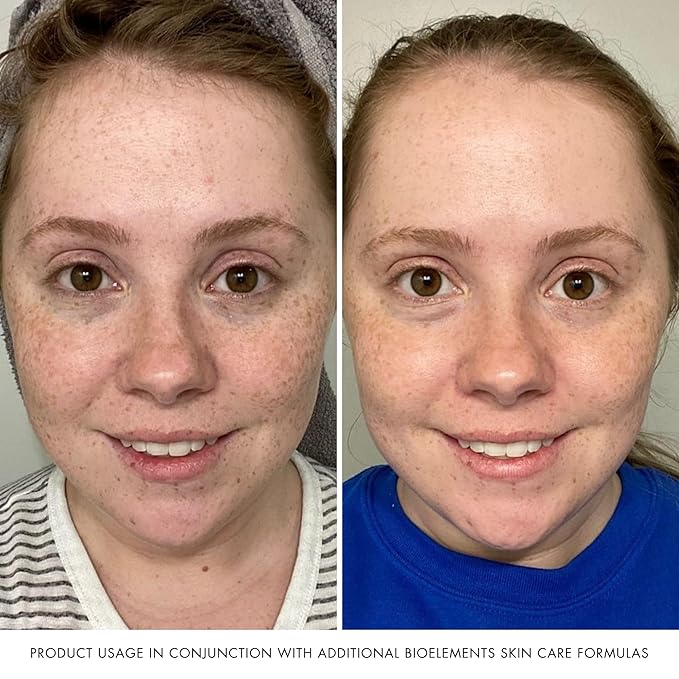 Bioelements Decongestant Cleanser - 6 fl oz - Lathering Gel Cleanser for Oily Skin - Vegan, Gluten Free