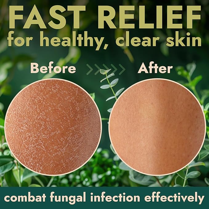 Antibacterial Body Wash | Antifungal Soap for Men & Women | Kills 99.9% of Germs & Bacteria | Helps with Back Acne, Body Odor & Jock Itch | Manuka Honey & Charcoal | Includes Scrubber16 fl oz