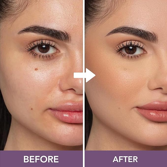 Dermaflage SPF Mineral Powder Sunscreen for Sensitive Skin, All Natural Sunscreen Powder, Broad Spectrum