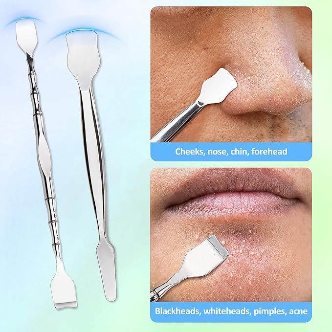 Blackhead Remover Pore Prep Tool Kit, 5PCS: 2× Blackhead Shovels, 2× Hair Tweezers, 1× 5X Mirror, Pimple Popper Tool, Stainless Pore Scraper, Comedone Extractor Tweezer Kit for Acne, Blemish (Black)