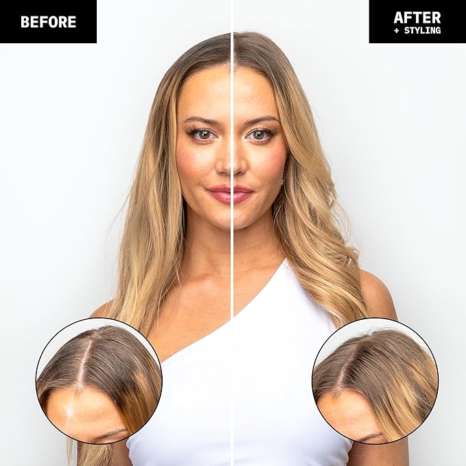 FoxyBae Overnight Dry Shampoo Spray – Biotin, Rice Starch & Charcoal Formula – Absorbs Oil, Sweat & Odor for Fine, Thick & Color-Treated Hair – Dream Refresh – 7 fl oz