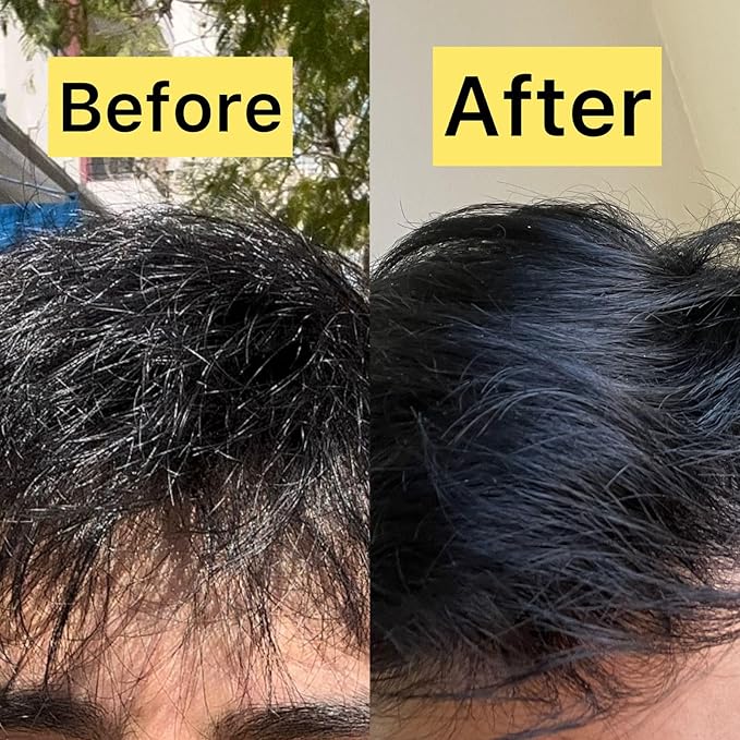 Pallure Transparent Hair Oil Treatment, To Support Thicker, Voluminous, Fuller Looking Hair, Infused with Hyaluronic Acid, Biotin, Avocado and Rosemary Oil (3.4 Fl Oz)