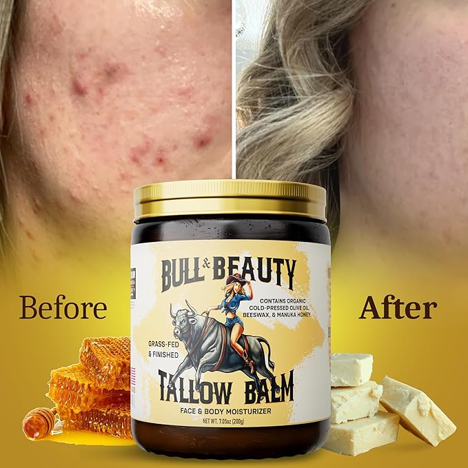 Bull & Beauty Organic Beef Tallow and Honey Balm 7.05oz Organic Beef Tallow for Skin - 100% Grass-Fed Unscented Beef Tallow Moisturizer for Skin & Face with Manuka Honey, Olive Oil & Beeswax