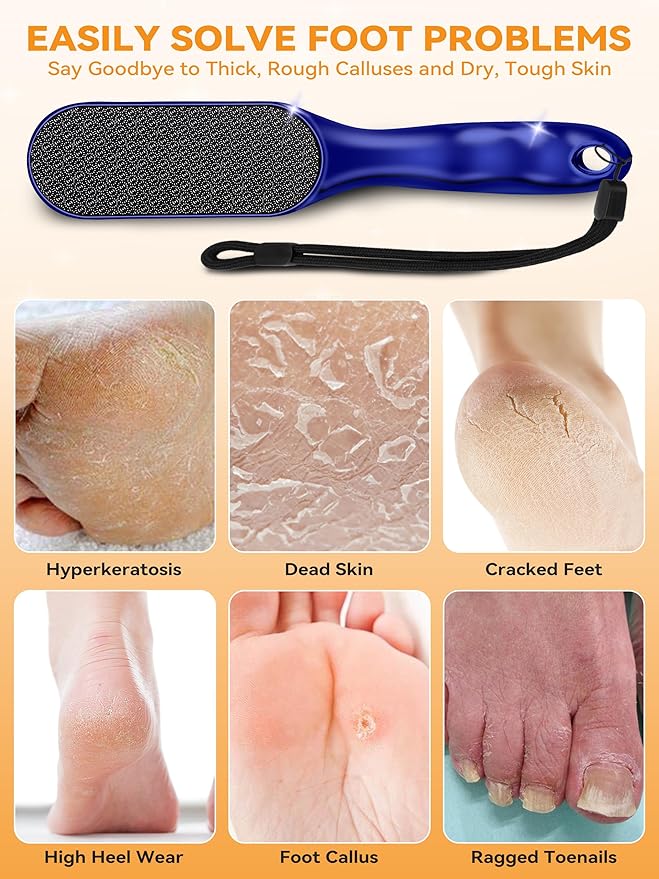 Nano Glass Foot File Foot Callus Remover Scrubber in Shower, Pedicure Tools Feet Scrubber Dead Hard Skin, Anti-Slip Handle Rope & Storage Bag Foot Files for Wet and Dry Feet Care Gift Blue