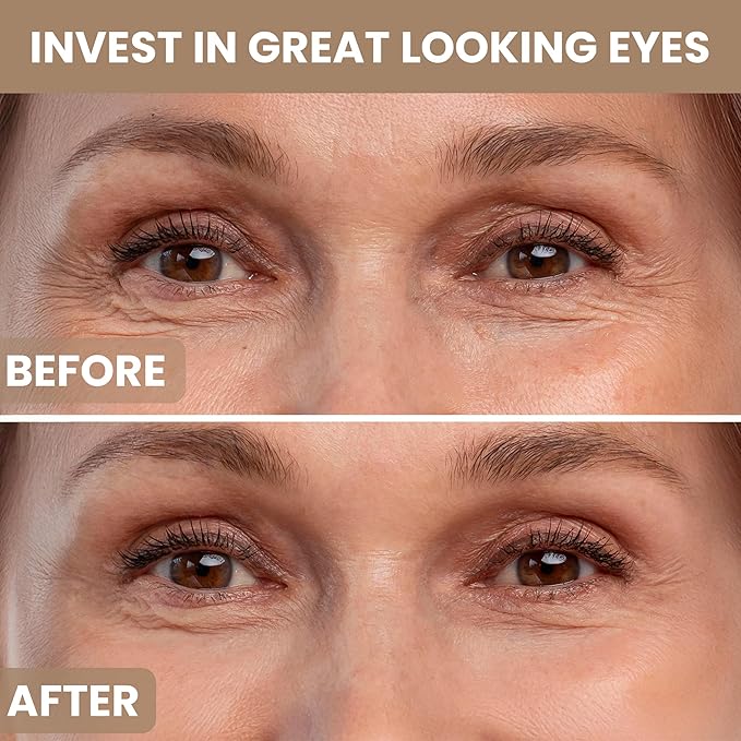 Plant Stem Cell Eye Serum Complex | Aloe Vera, Vitamin C | Hydrating Eye Treatment | Airless Pump - 15ml