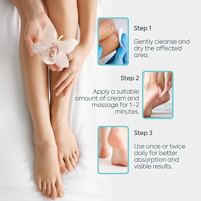 Foot Moisturizing Cream – Hydrating Heel & Foot Cream with Vitamin E and Avocado Oil – Softens Dry, Rough Skin – Nourishing Daily Foot Care, 100 ml