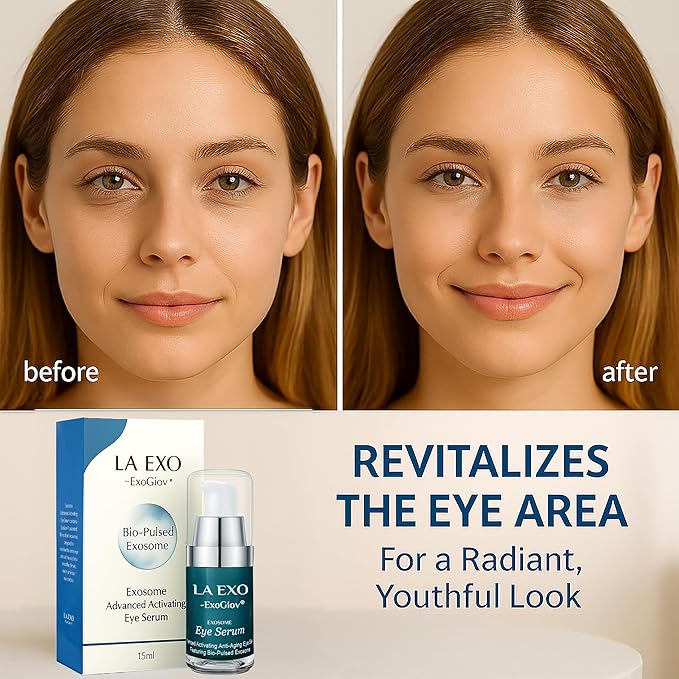 Exosome Eye Serum – Advanced Anti-Aging Eye Treatment for Puffiness, Dark Circles & Fine Lines – Brightening, Smoothing & Hydrating Undereye Skin Care for a Youthful Look – 15ml