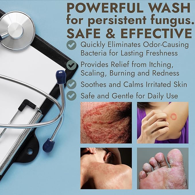 Antibacterial Body Wash | Antifungal Soap for Men & Women | Kills 99.9% of Germs & Bacteria | Helps with Back Acne, Body Odor & Jock Itch | Manuka Honey & Charcoal | Includes Scrubber16 fl oz