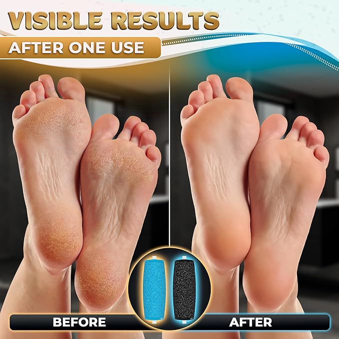 11 Pcs Replacement Rollers for Electric Foot Callus Remover Tool - 7 Extra Coarse & 4 Regular Coarse Refill Heads (1.92 x 0.65 Inches), Micro-Diamond Crystals - Compatible with Amope Pedi Perfect Pro