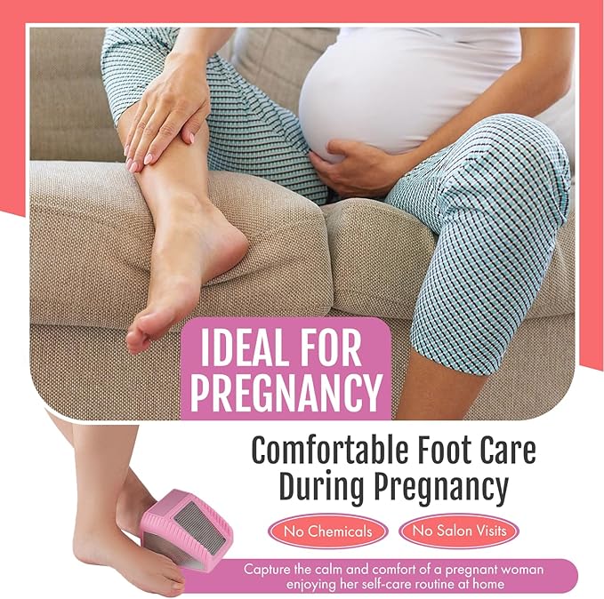 Wonex U.S. Patented 3-in-1 Foot Scrubber – No-Bend Callus Remover, Nano Glass Buffer & Polisher for Smooth Feet – Ideal for Senior Aids, Pregnancy Must-Haves, Back & Knee Surgery Recovery Gift (Pink)