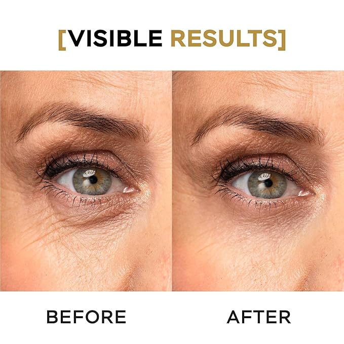 VITASEI Moisturizing Night Serum w/Hyaluronic Acid, Cucumber, Grape & Coffee Extract for Dark Circles, Puffiness & Bags - Under Eye Hydration Serum for Women & Men (0.67 Fl Oz)