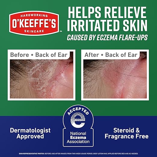 O’Keeffe’s Skin Repair Eczema Relief Body Cream, 7oz Tube (Pack of 1) – 48 Hour Itch Relief in One Use