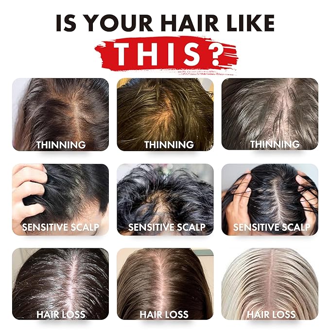 ALFHEIM Coffee+ Thickening Shampoo & Conditioner Set for Fine, Thin & Weak Hair with Caffeine, Biotin & Arabica Coffee Oil – Strengthening, Moisturizing & Volumizing Duo – Sulfate-Free – 33.8 oz × 2