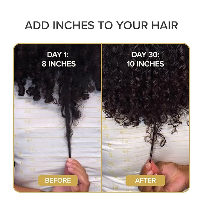 Shedavi Iconic Vegan Hair Serum with Botanicals - Growth Treatment for Women & Men's Dry, Damaged Hair and Scalp with Argan, Coconut, Castor, and Tea Tree Oils