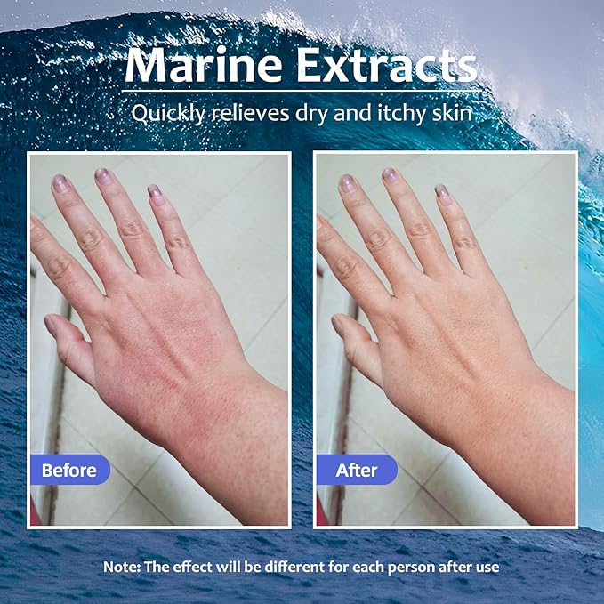 Crogooe Natural Organic Eczema Soothing Cream Made With Sea Moss Aloe Vera, Oats! Sensitive Skin Dry Skin Hydrating Comfort Moisture Fragrance Free Skin care