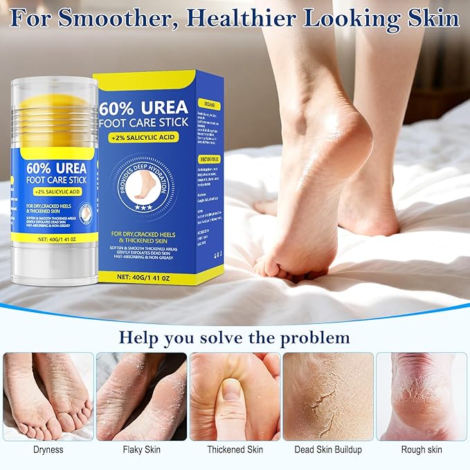 60% Urea & 2% Salicylic Acid Foot Cream for Cracked Heels, Intensive Moisturizing and Anti-Cracking, Repairs Dry and Rough Skin, Fast Absorbing, Callus Remover for Feet, Hands, Knees, Elbows (2)
