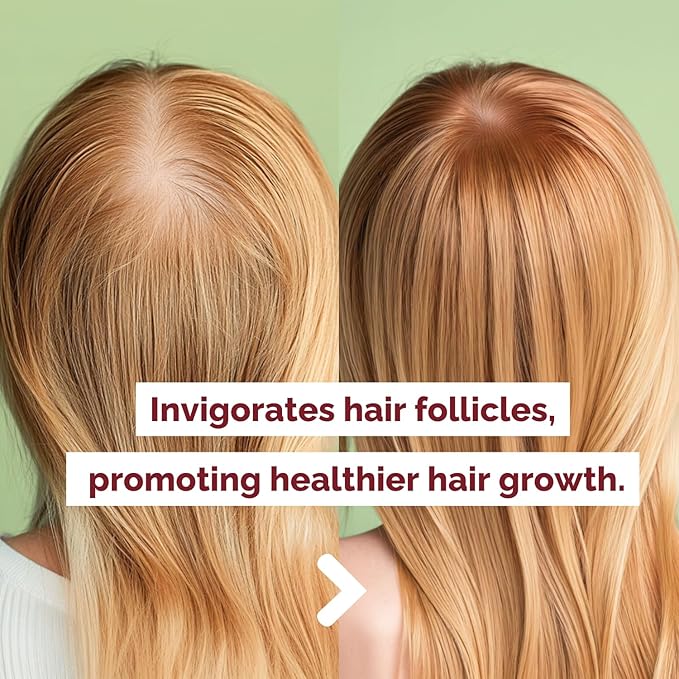 Just Nutritive Onion & Rosemary Shampoo for Hair Growth, Thickening, Strengthening - Sulfate-Free, Enriched with Red Onion Oil, Rosemary Oil, Tea Tree - 16 oz