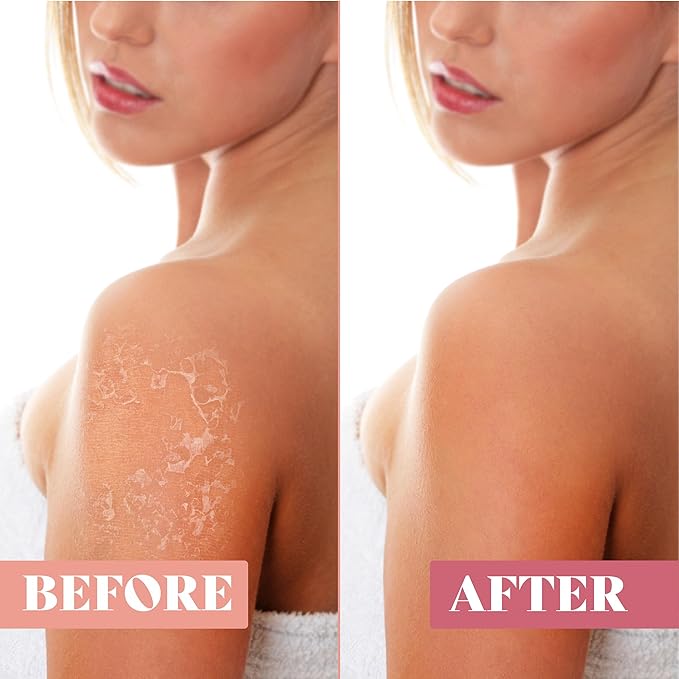 Exfoliating Glove (4 PCS) - Turkish Hammam Mitt for Bath, Exfoliating Body Scrubber Mitt, Dead & Dry Skin Remover for Body, Great for Spray Tan Removal, Smooth Skin Surface