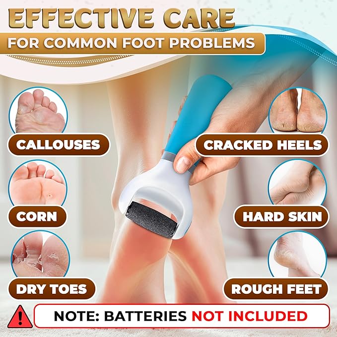 Electric Foot Callus Remover Tool | Batteries Not Included – High-Speed Foot Grinder with Easy-to-Replace Roller – On-The-Go Electric Callus Remover for Feet | Pedicure Tools for Feet Smoothing