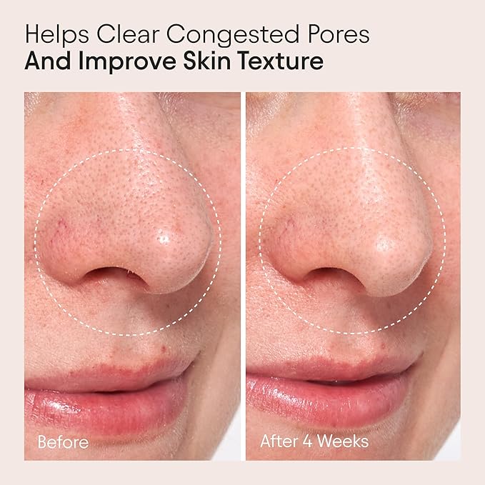 ALPYN Clarifying Facial Oil with Retinol & Pink Algae | Clear Congestion, Smooth Fine Lines, Improve Texture & Glow | 1 Fl Oz / 30 ml