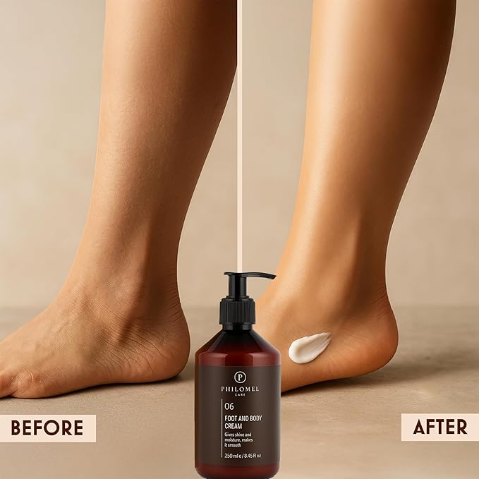 Body and Foot Cream - Nourishing Cream for Dry Skin Urea Cream 40 Percent for Feet Maximum Strength