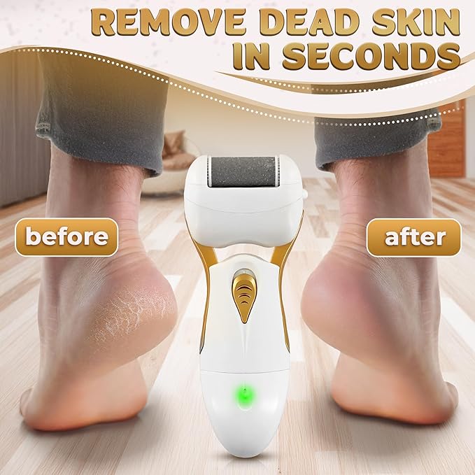 Electric Callus Remover for Feet – 5W Electric Foot Filer, 90-Min Runtime Foot Sander with Fast 2H Charge & 3 Replacement Rollers – Hard Skin Remover for Feet with Ergonomic Handle for Easy Grip