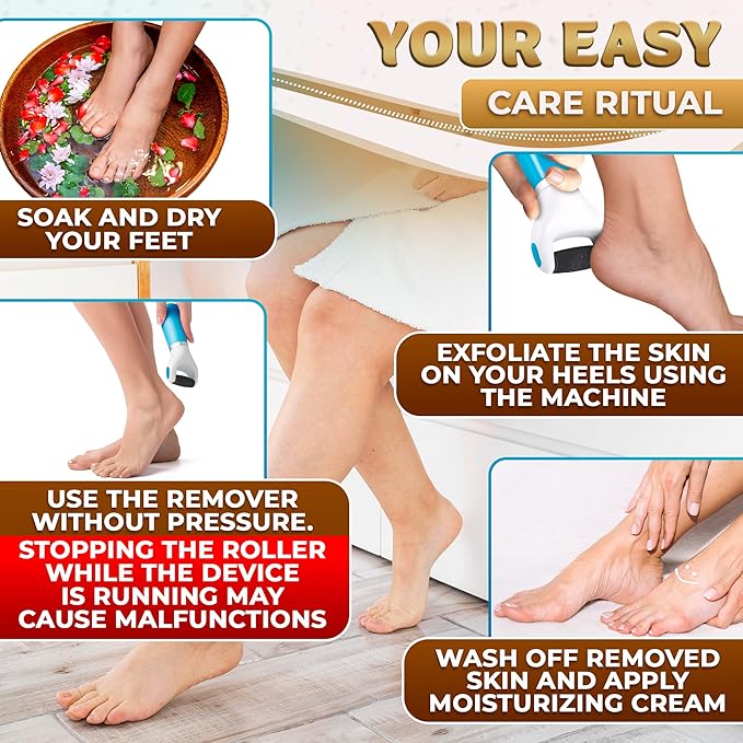 Electric Foot Callus Remover Tool | Batteries Not Included – High-Speed Foot Grinder with Easy-to-Replace Roller – On-The-Go Electric Callus Remover for Feet | Pedicure Tools for Feet Smoothing
