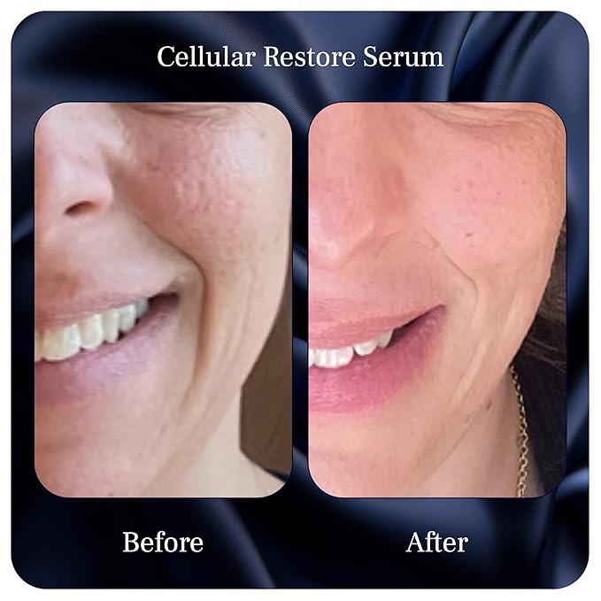 PUREANCE Organic Bakuchiol Plumping Serum - Bakuchiol for Face Skin and Wrinkles - Cellular Restore Serum - With Jojoba Oil, Sea Buckthorn, Camu Camu, Babchi, Maple Leaf Extracts & More - 1 Fl Oz