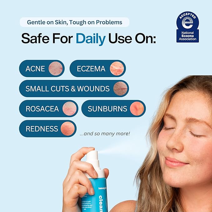 Hypochlorous Acid Spray – Dermatologist Tested HOCl Facial Cleanser for Sensitive, Acne-Prone & Irritated Skin – Soothes Redness, Eczema, Rashes & Itching – Skin Repair Spray, 6.8 oz - Honeydew Labs