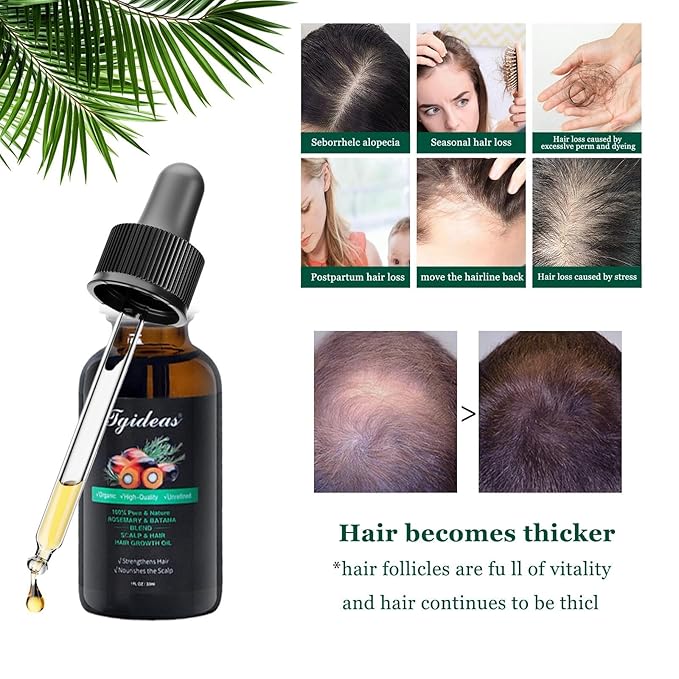Tgideas Rosemary Batana Oil - Organic Hair Growth -for Scalp & Hair Strengthening - All Hair Types Treatment Oil - Eyebrow & Eyelash Nourishing