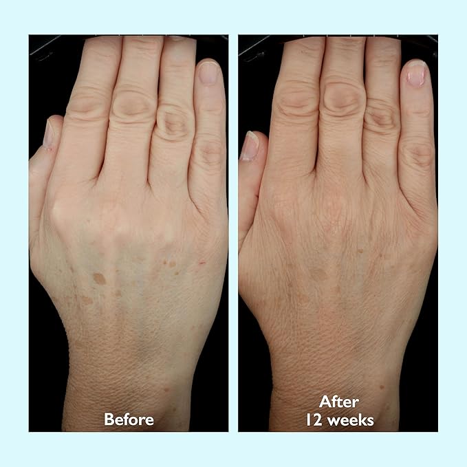 Restorsea PRO Intensive Hand Treatment 10X – Anti-Aging Hand Cream with 10% More Aquabeautine XL – Brightens Dark Spots, Hydrates Dry Skin, Boosts Elasticity – Quick-Drying, Non-Greasy