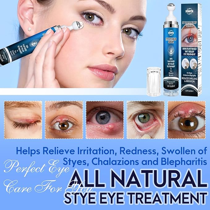 Stye Eye Treatment, Multi-Effect Eye Serum, Chalazion Soothing Care Drops with 360° Massage Rollerball - Moisture & Botanical Extract Formula, Cruelty-Free (1 Fl Oz (Pack of 1))