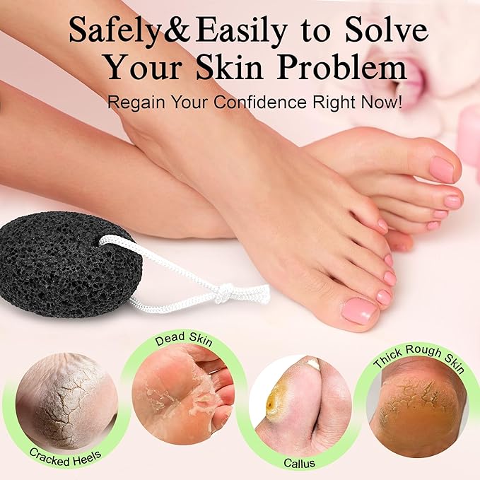 Natural Pumice Stone for Feet - Lava Foot Scrubber Dead Skin Corn Callus Remover Exfoliator Pedicure Tools for Feet Heels and Hands 2 Pack