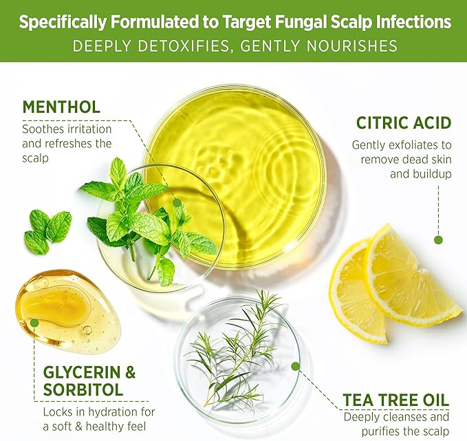 Roycederm Tea Tree Scalp Scrub – Pre-Shampoo Exfoliating Treatment for Dry, Flaky Scalp – Deep Cleansing, Refreshing & Balancing Formula for Healthy-Looking Hair