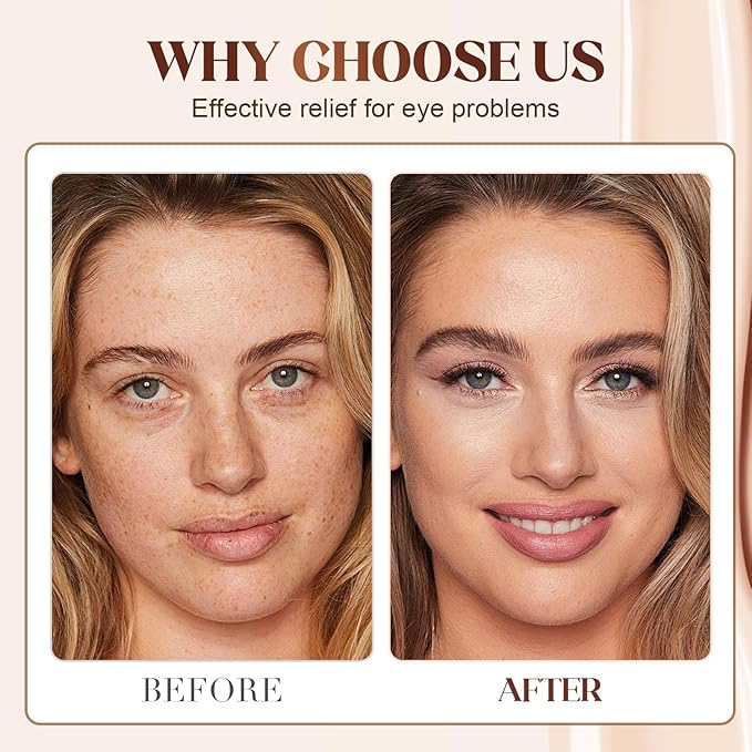 2PCS Lutein Eye Essence Oil, 2025 New VC Lutein Anti-Wrinkle Eye Serum Oil, Hydrating Dark Circles Remover for Daily Eyes Care, Lightweight Tightening Eyes Oils for Women (0.3 Fl Oz (Pack of 1), 2PCS)