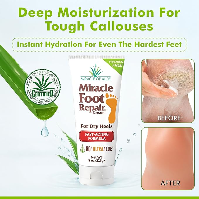 Miracle Foot Repair Cream (8 oz / 2-Pack) Repairs Dry Cracked Heels and Feet, 60% Pure UltraAloe Moisturizes, Softens, and Repairs