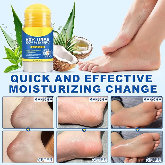 Urea Cream 60 Percent for Feet, Urea Foot Cream for Cracked Heels and Dry Skin, Cracked Heel Repair Cream Plus 2% Salicylic Acid, Foot Cream for Calluses and Hard Skin 1PCS