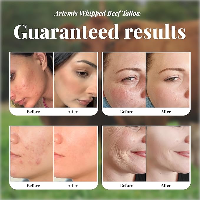 Beef Tallow for Skin - Beef Tallow face and body Balm, Natural Cream, 6 oz (Pack of 1) | Grass-Fed Beef Tallow, All-Natural Moisturizer, Whipped Beef tallow Cream for Smooth Skin, Vitamins A, C, D, E