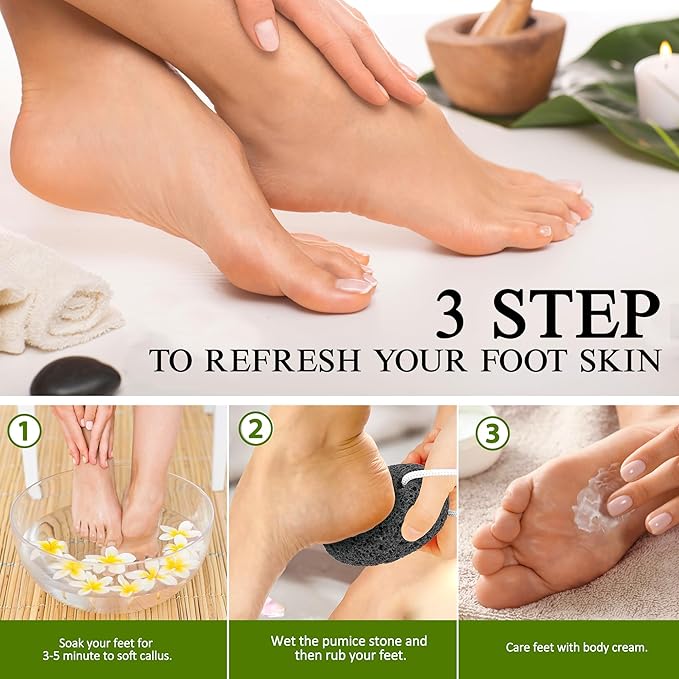Natural Pumice Stone for Feet - Lava Foot Scrubber Dead Skin Corn Callus Remover Exfoliator Pedicure Tools for Feet Heels and Hands 2 Pack