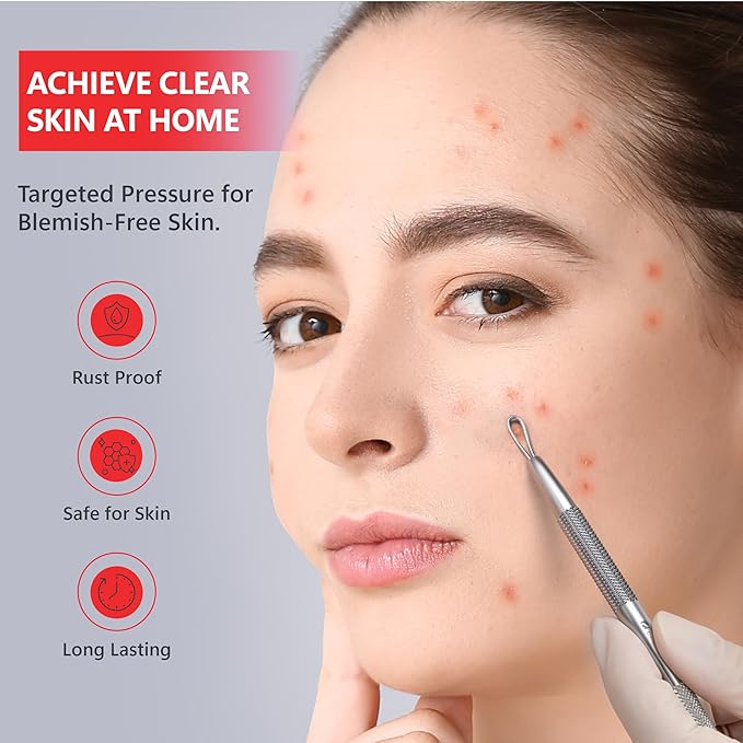 Suvorna White Head Remover for Face, Pimple Extractor, Pimple Popper, Whitehead Remover for Face, Comedone Extractor Tool, Pimple Extractor Tool, Pimple Popper Tool