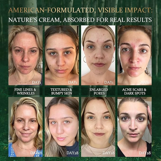 Moisturizing Crepe Fix Cream – Tightens and Firms Face, Neck & Body, Anti Wrinkles for Crepey and Sagging Skin, Christmas Gift for Men & Women, 1.75 Fl Oz